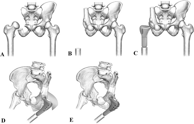 Fig. 1A-E