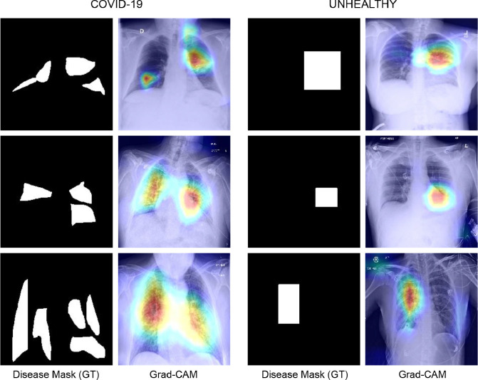 Fig. 12