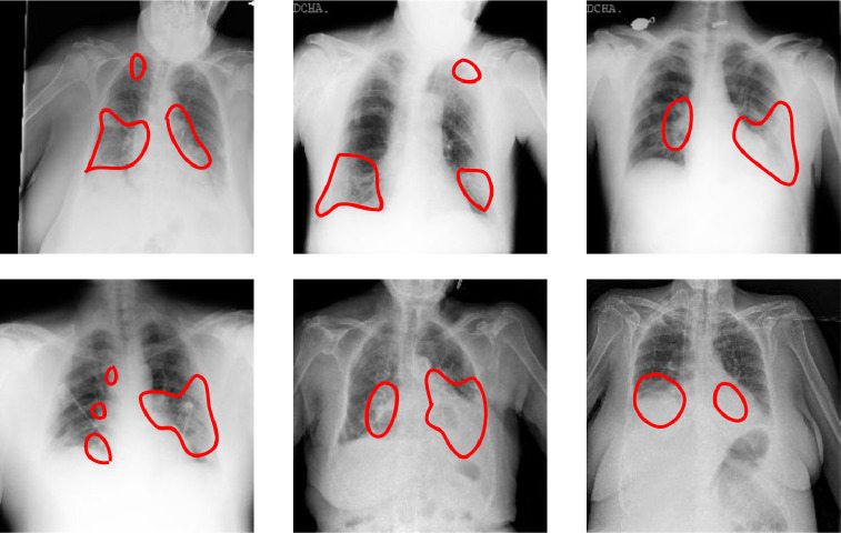 Fig. 13