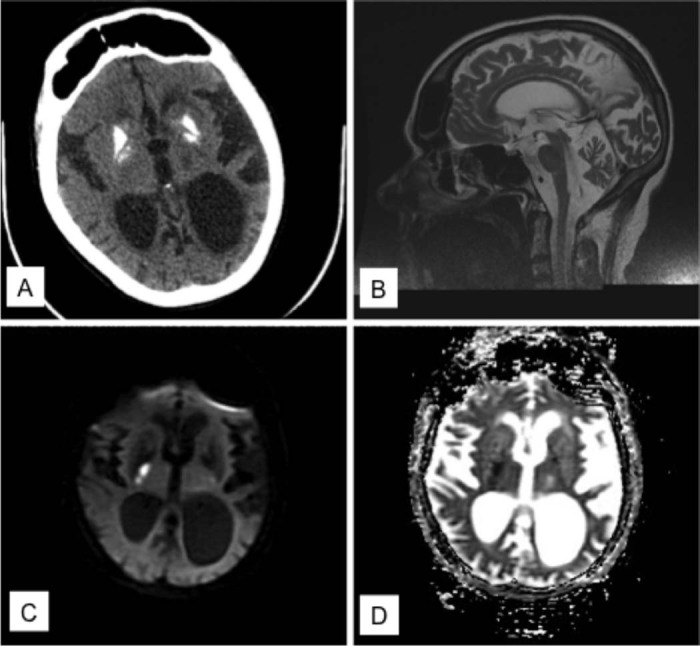 Fig. 1