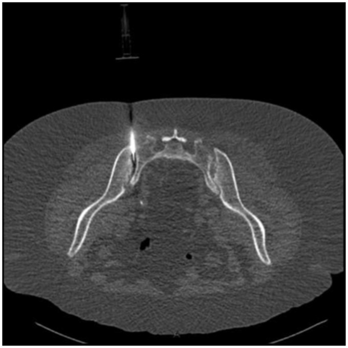 Fig. 6.