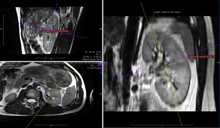 Fig. 2