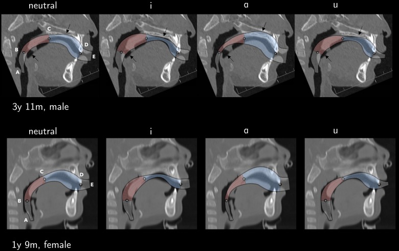 FIG. 11.