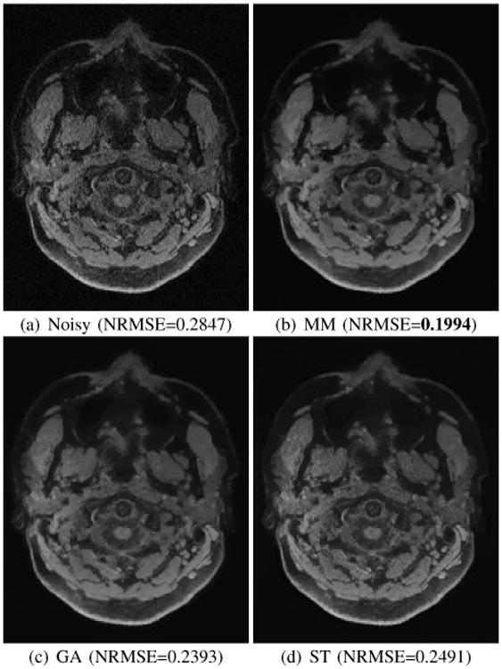 Fig. 11