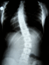 Figure 32