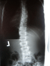 Figure 23
