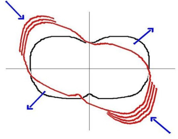 Figure 11