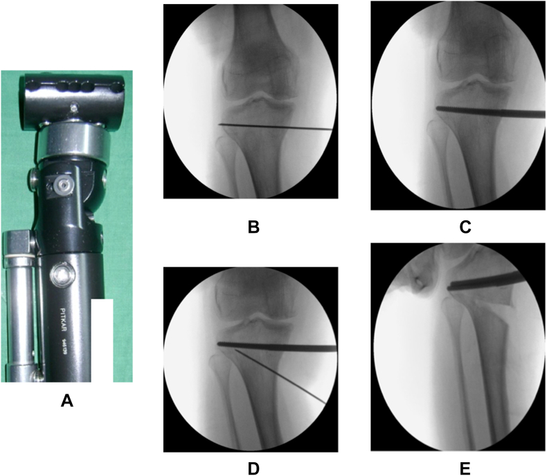 Fig. 1