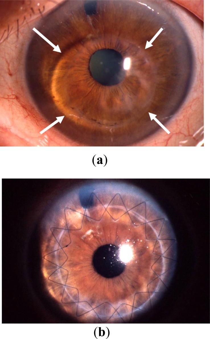 Fig. (11)