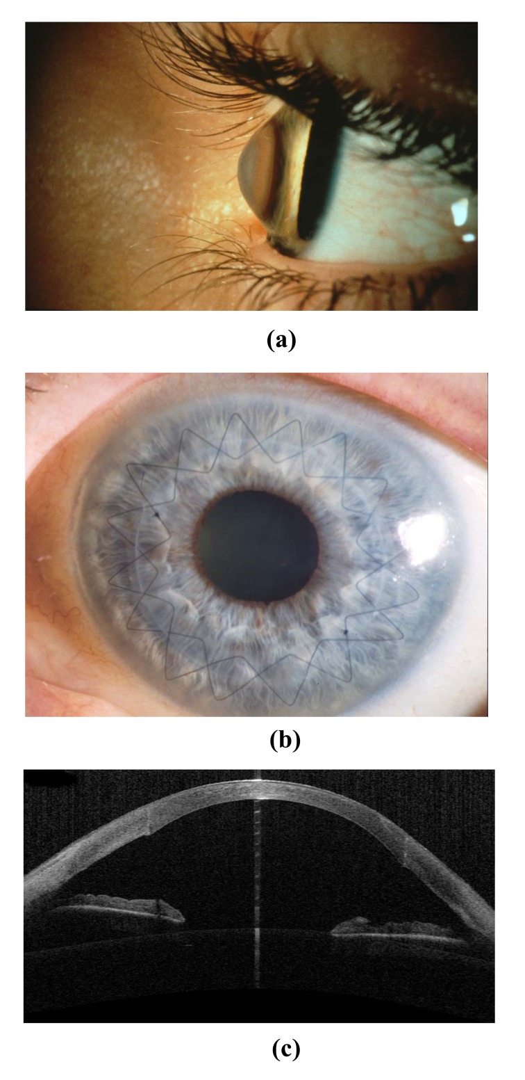 Fig. (7)