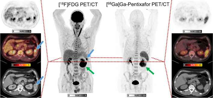 Fig. 2