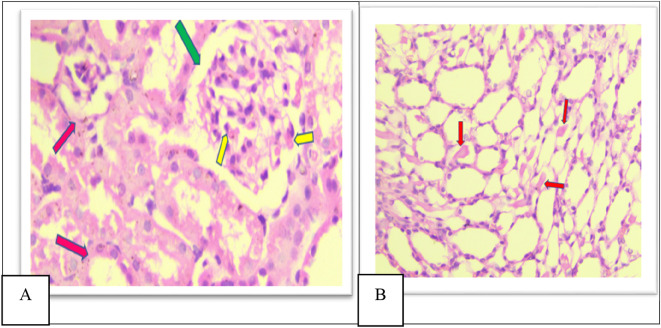 Figure 10. 