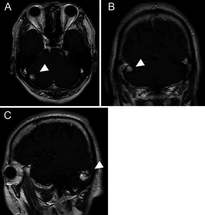 FIG. 1