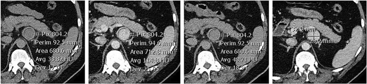 Fig. 1