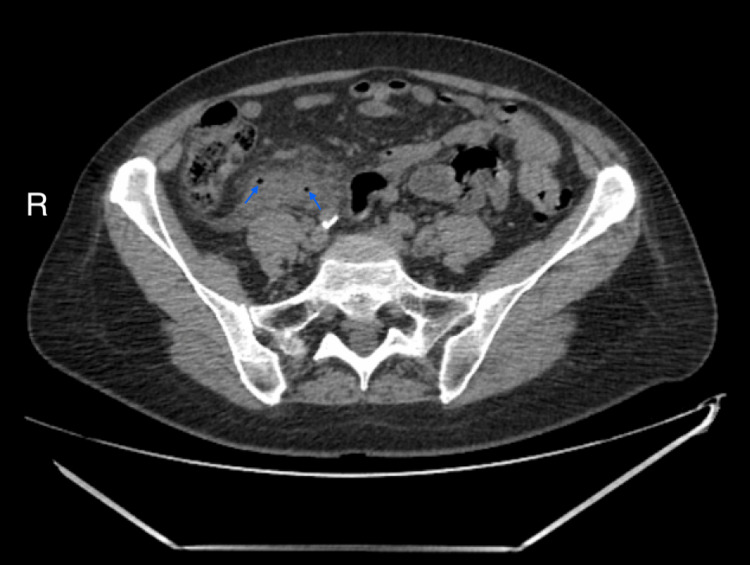 Figure 9