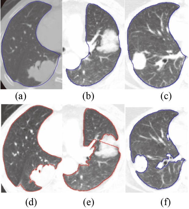 Figure 13.