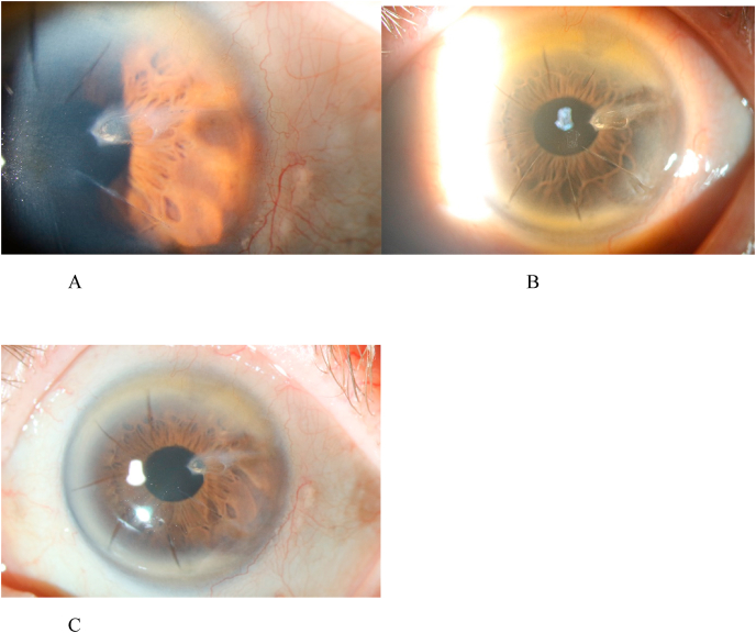 Fig. 4