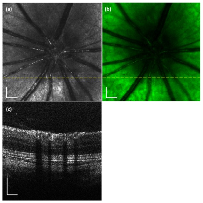 Fig. 3