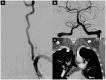 Fig 2