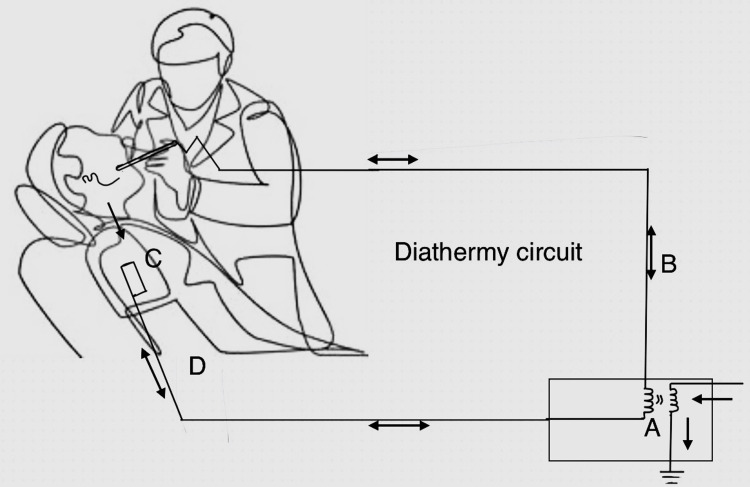 Frontier Breakthroughs: A Comprehensive Review of Diathermy in ...