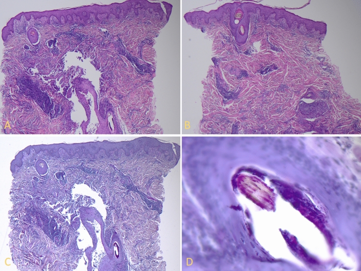 Fig. 2