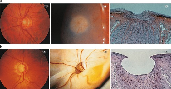 Fig. 1