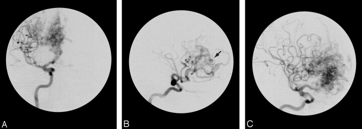 Fig 2.