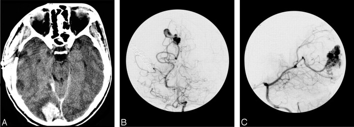 Fig 3.