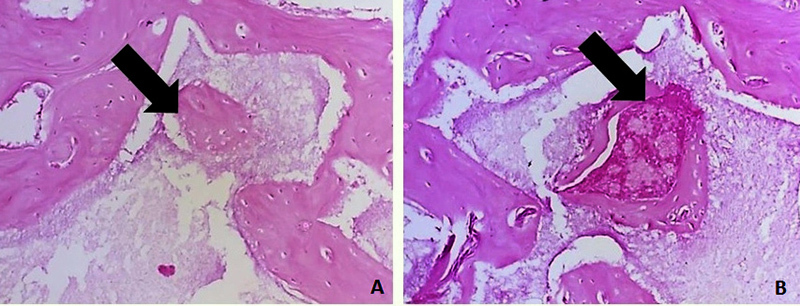 Figure 14.