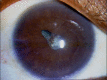 Figure 2a