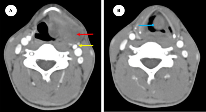 Figure 1