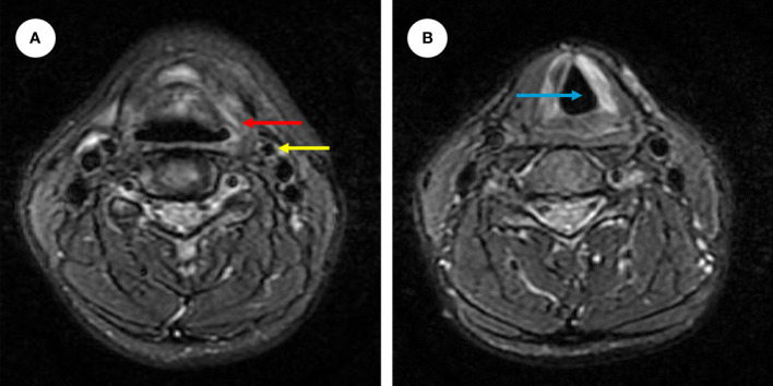 Figure 4