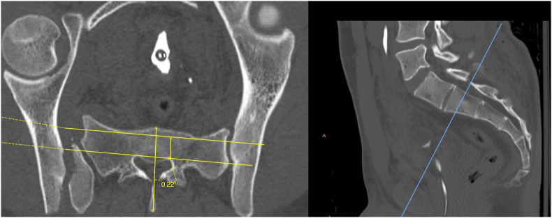 Fig. 2