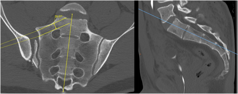 Fig. 2