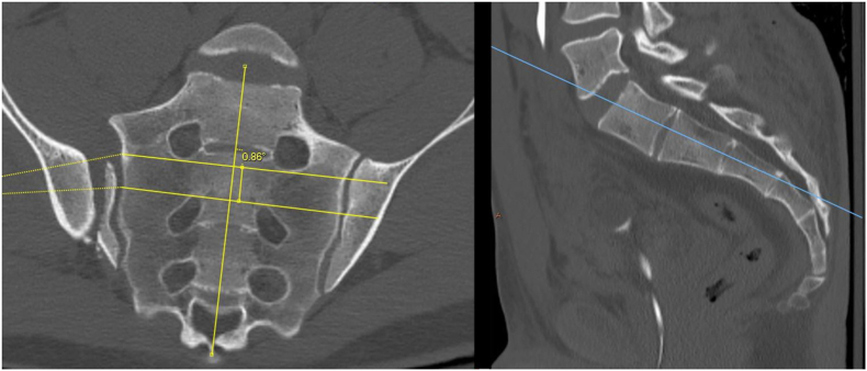 Fig. 2