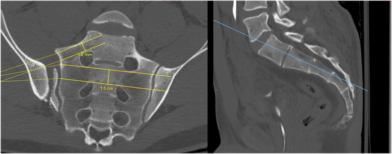 Fig. 1