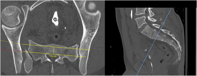 Fig. 1