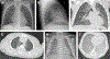 Fig. 2.