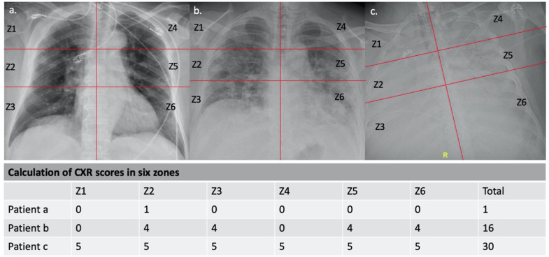 FIG 2