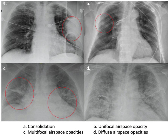 FIG 1