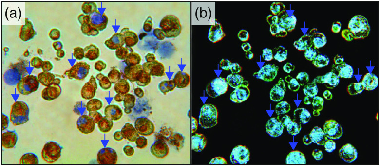 Fig. 17