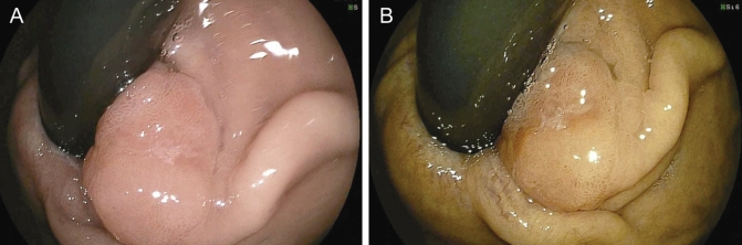 Figure 4)