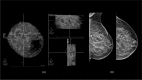 Fig. 5