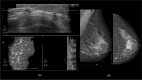 Fig. 6