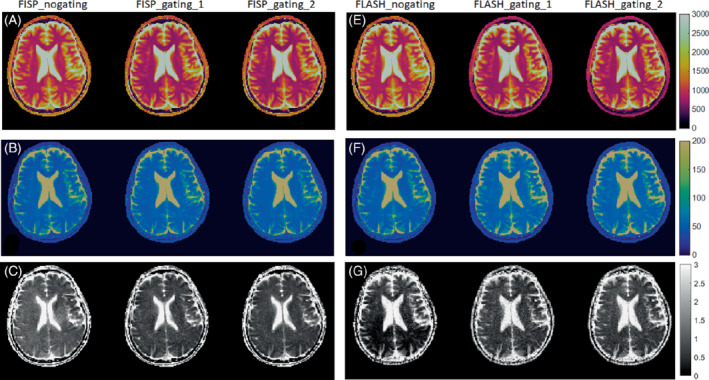 MRM-29352-FIG-0004-c