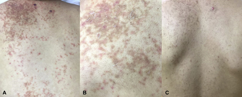 Fig 1
