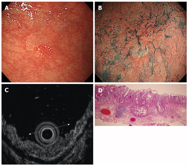 Figure 14