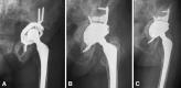 Fig. 3A–C