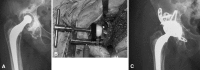 Fig. 5A–C