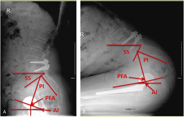 Fig. 2 A-B